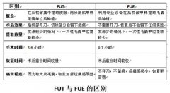 广州植发技术哪家好