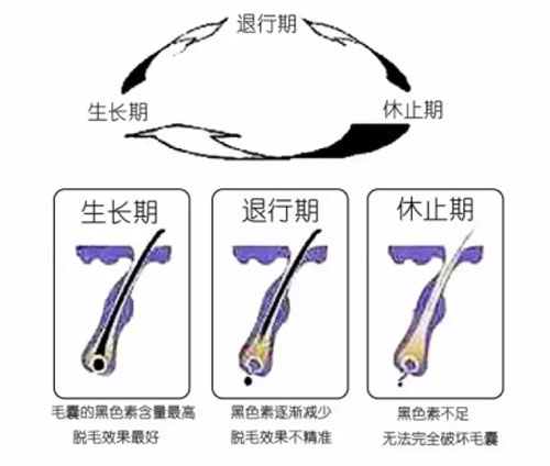 种植头发问题