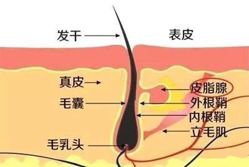 种植头发