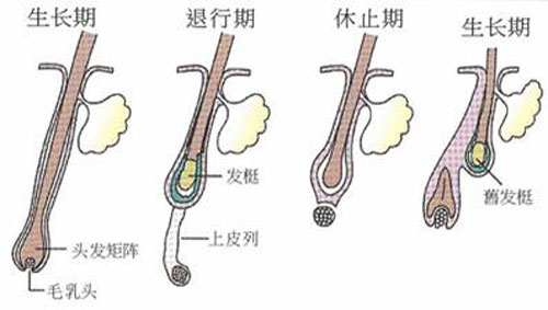 种植头发