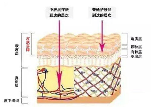 发际线高