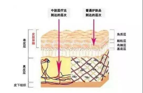 毛囊炎